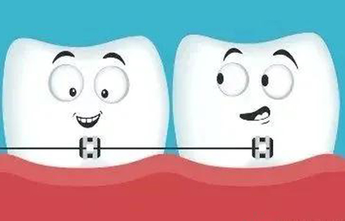 别让这10个牙齿矫正“愚论”，影响你的正畸