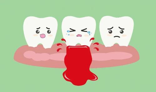 牙龈出血要小心，市口腔医院牙周科为您除隐患！