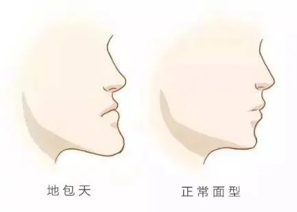 反颌1.jpg