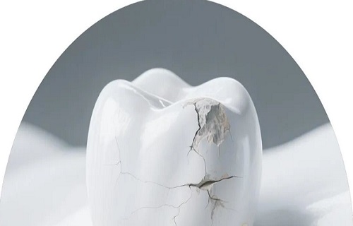 科普 | 牙齿不是金刚钻——警惕牙齿过度磨损！