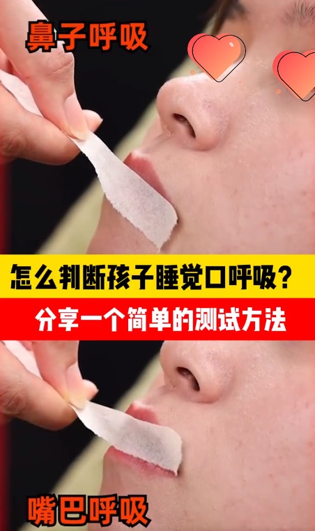 口呼吸3.jpg